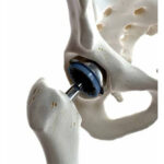 Tips for Healthy Knees and Strong Joints as You Age: From a Knee Specialist